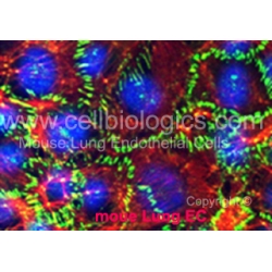 BKS db Control Mouse Skeletal Muscle Microvascular Endothelial Cells
